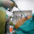 Understanding Gastric Bypass Surgery: A Comprehensive Guide to Medical Weight Loss