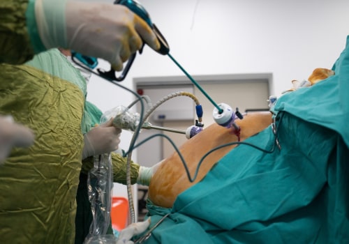 Understanding Gastric Bypass Surgery: A Comprehensive Guide to Medical Weight Loss